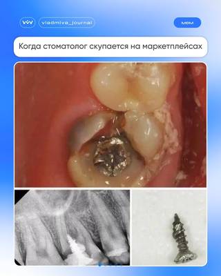 Маркетплейсы не для стоматологов: долгая доставка.